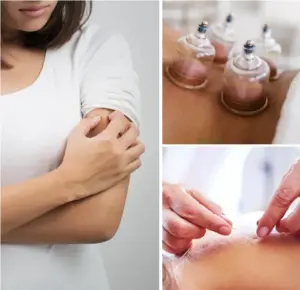 Orticaria